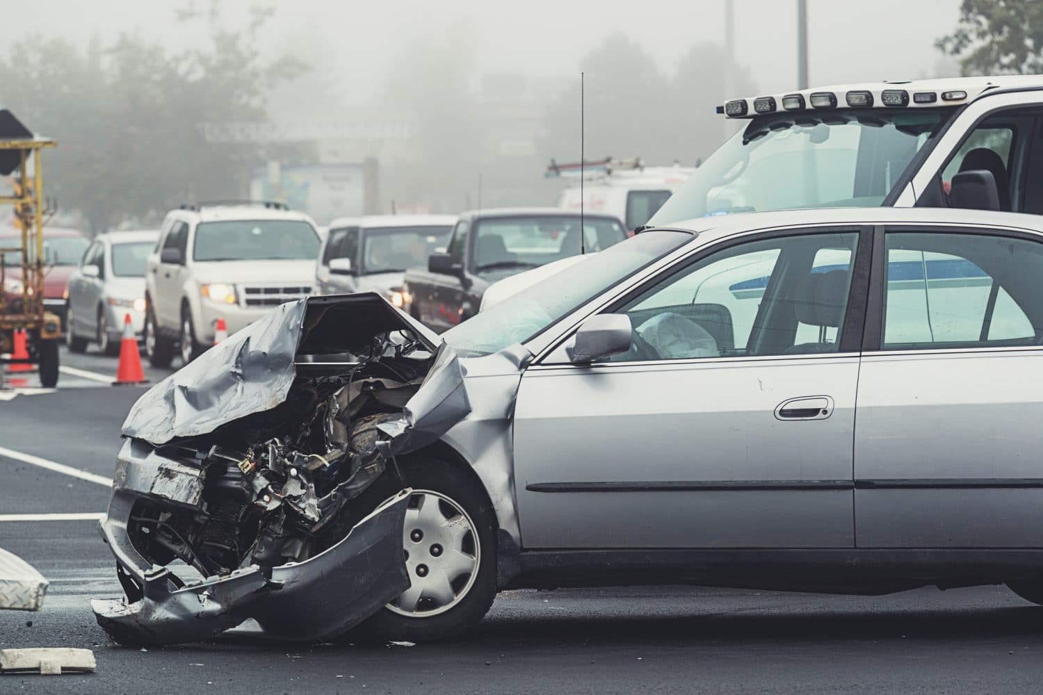 Everything You Need to Know About Car Accident TBIs