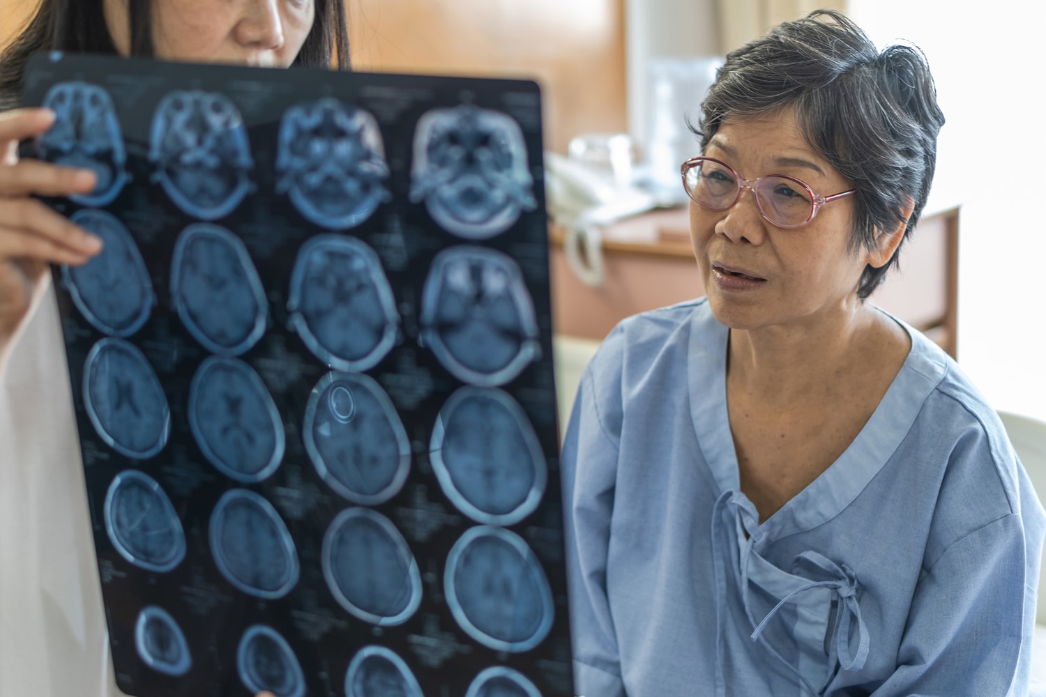 10 Strategies That Will Help You Navigate a Brain Injury Lawsuit