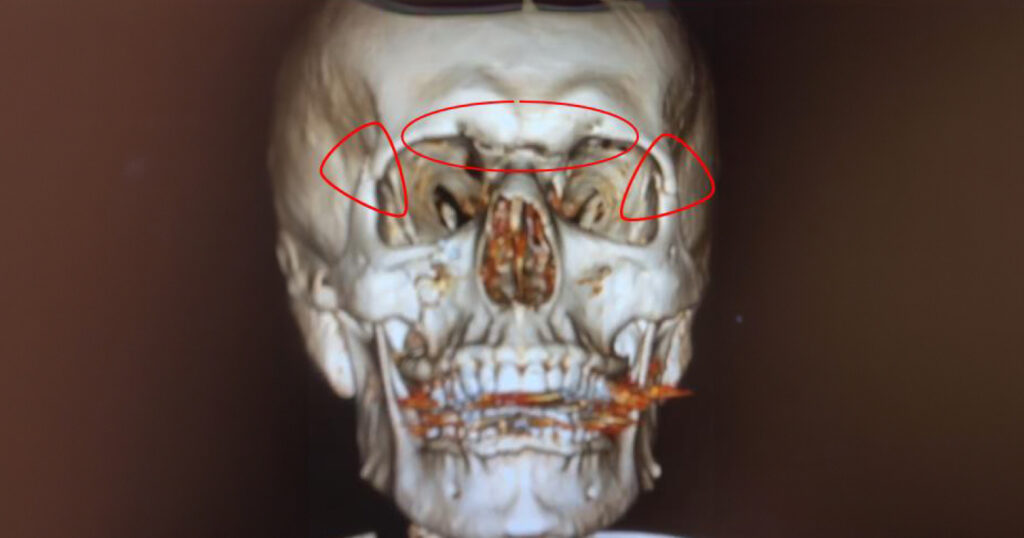 V1A CrosleyLaw Michael ClientStory image01 0424