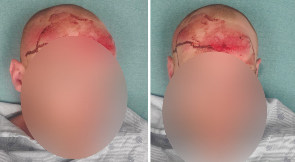 Post-crash photos showing Seth's head injury.