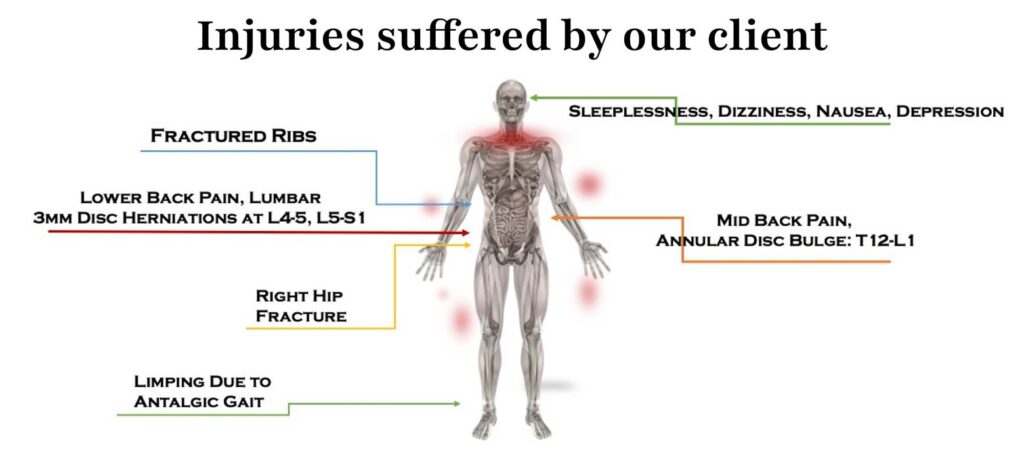 diagram showing injuries suffered by a client after a car accident