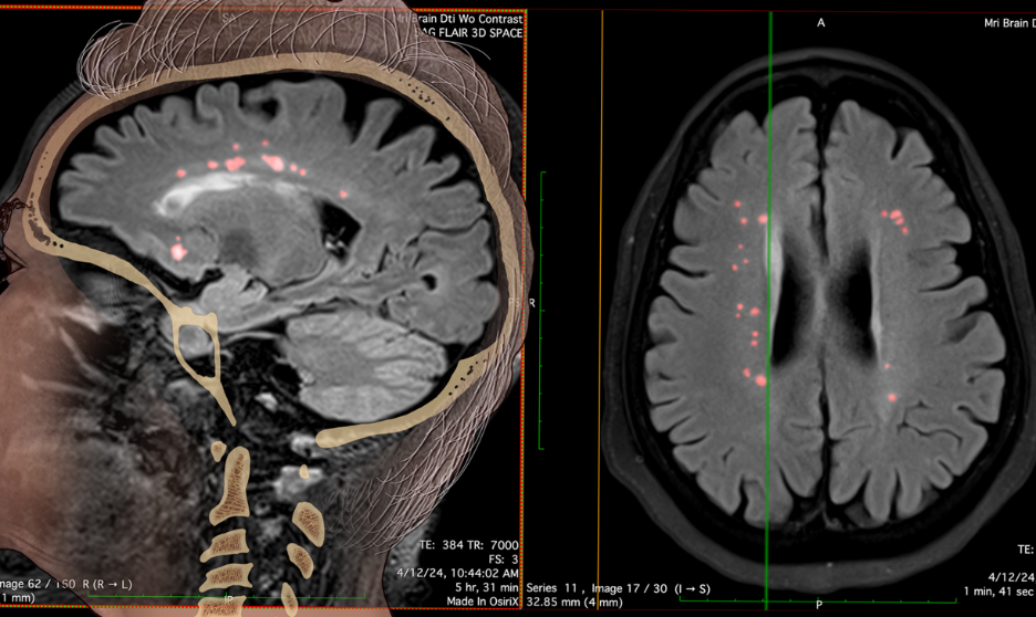 Contrast image of a womans brain