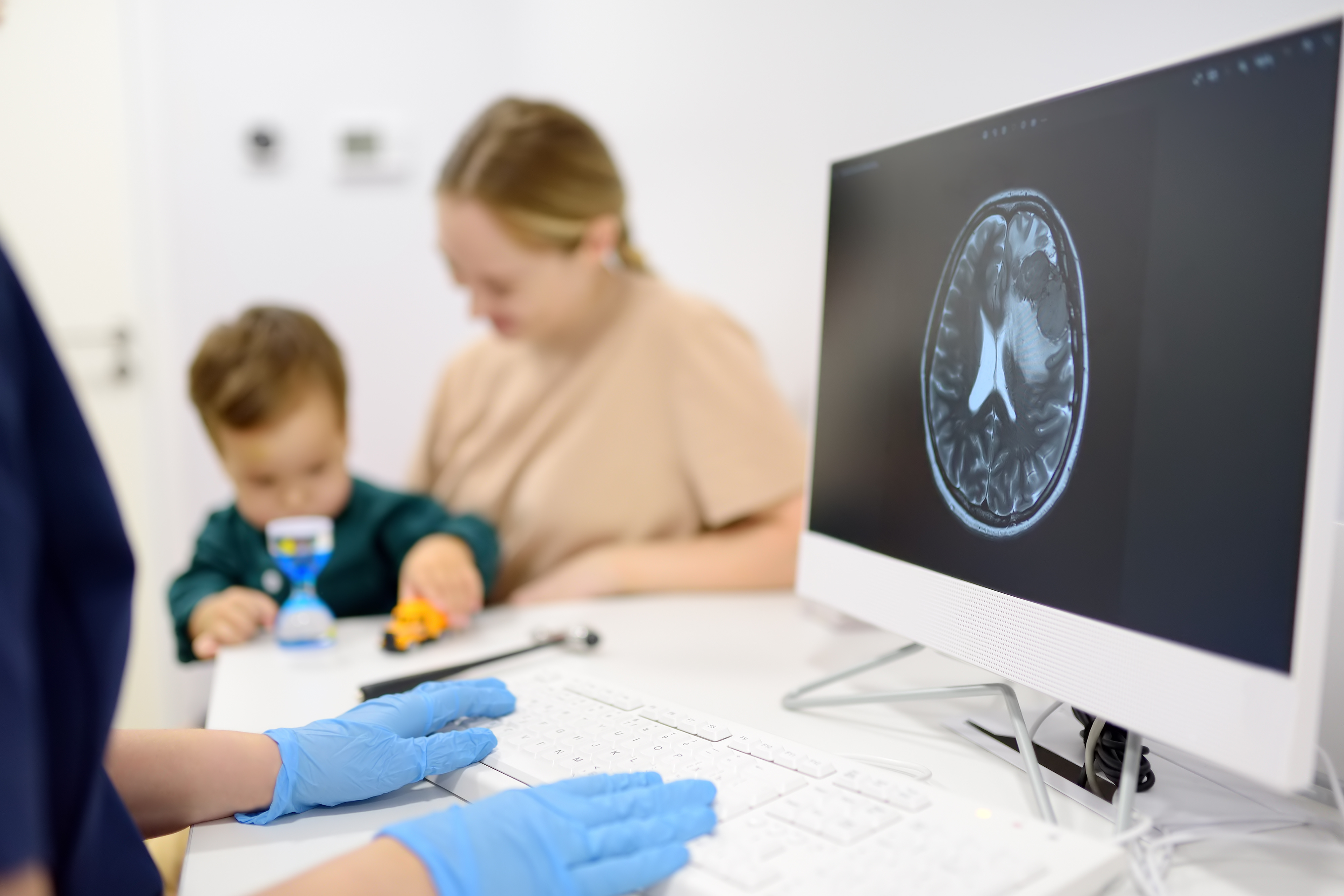 Concussions in toddlers and small children: what parents should know 2 Un médico revisa la resonancia magnética cerebral de un niño mientras los padres y el pequeño esperan en la sala de consultas de pediatría